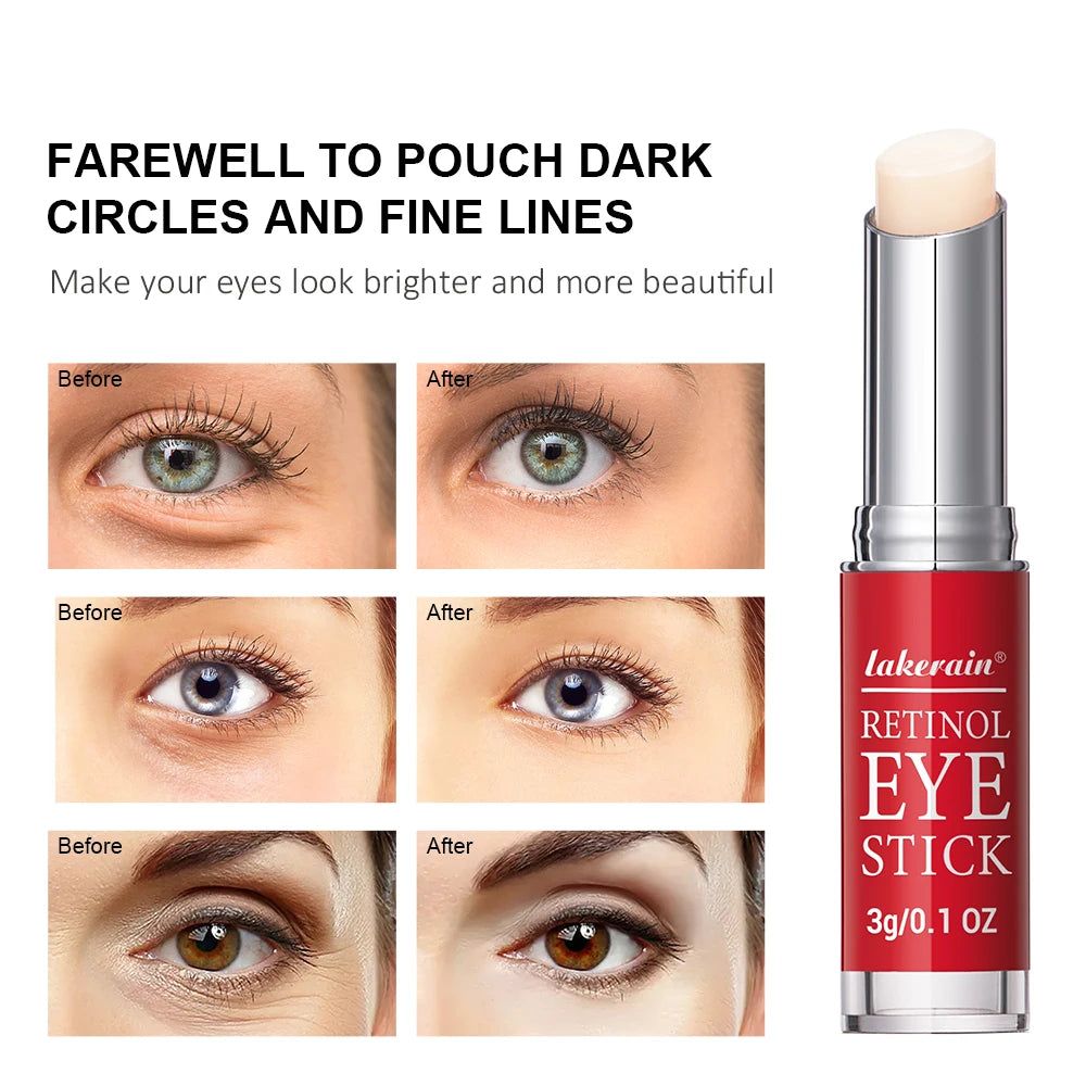 Retinol Eye Repair Stick — Anti-Aging Dark Circle & Firming Eye Serum